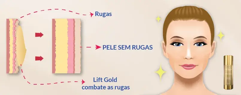 Imagem esquerda